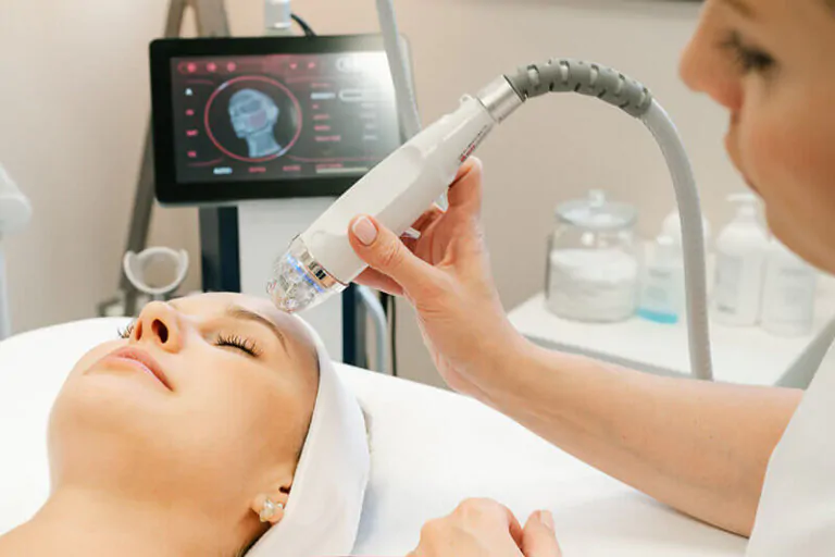 Radiofrekvencija mikroiglama Rf lifting bez skalpela